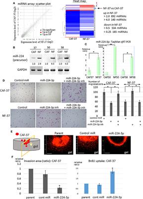 CCDC85A is regulated by miR-224-3p and augments cancer cell resistance to endoplasmic reticulum stress